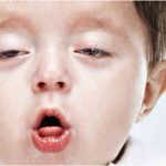 lam-the-nao-de-chua-khoi-ho-trong-24-gio-dau-01