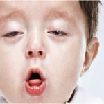 lam-the-nao-de-chua-khoi-ho-trong-24-gio-dau